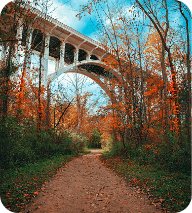 Hair Transplant in Germany